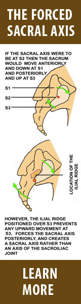 Forced Sacral Axis